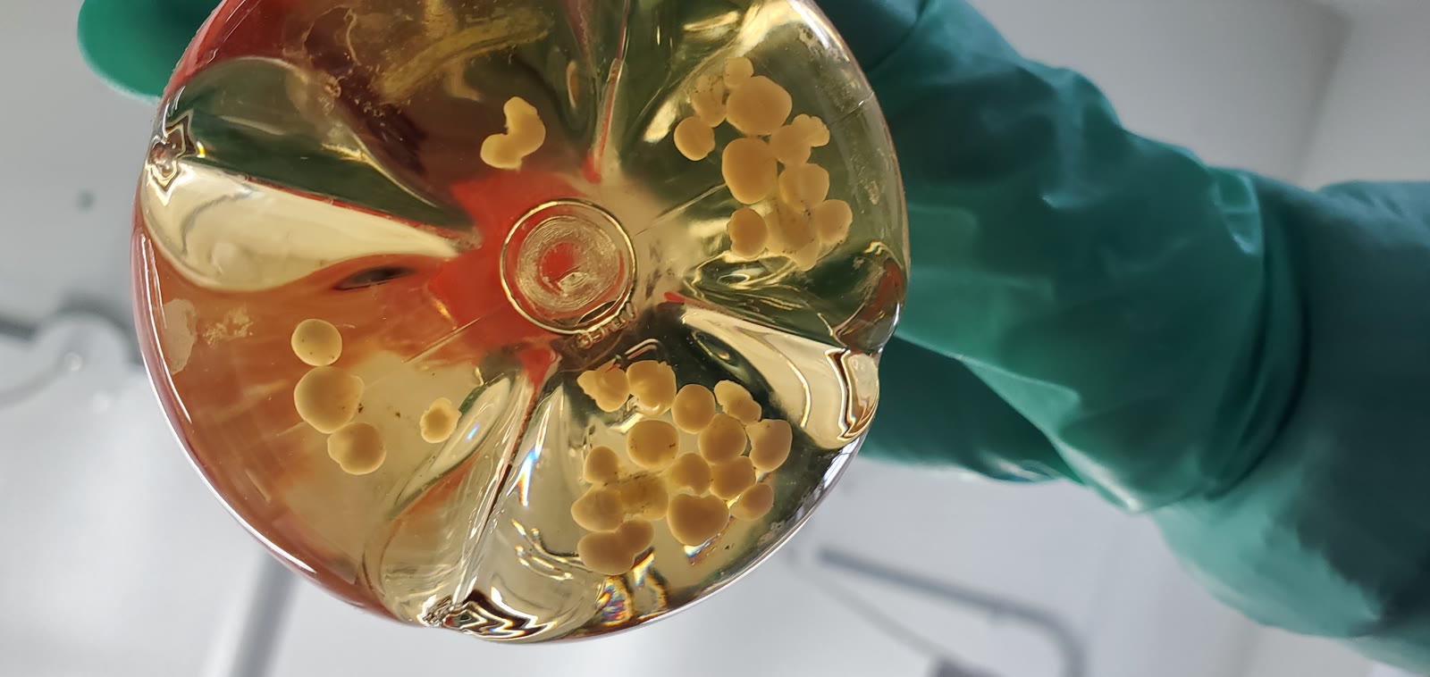 A researcher holds a flask containing dozens of human cerebral organoids