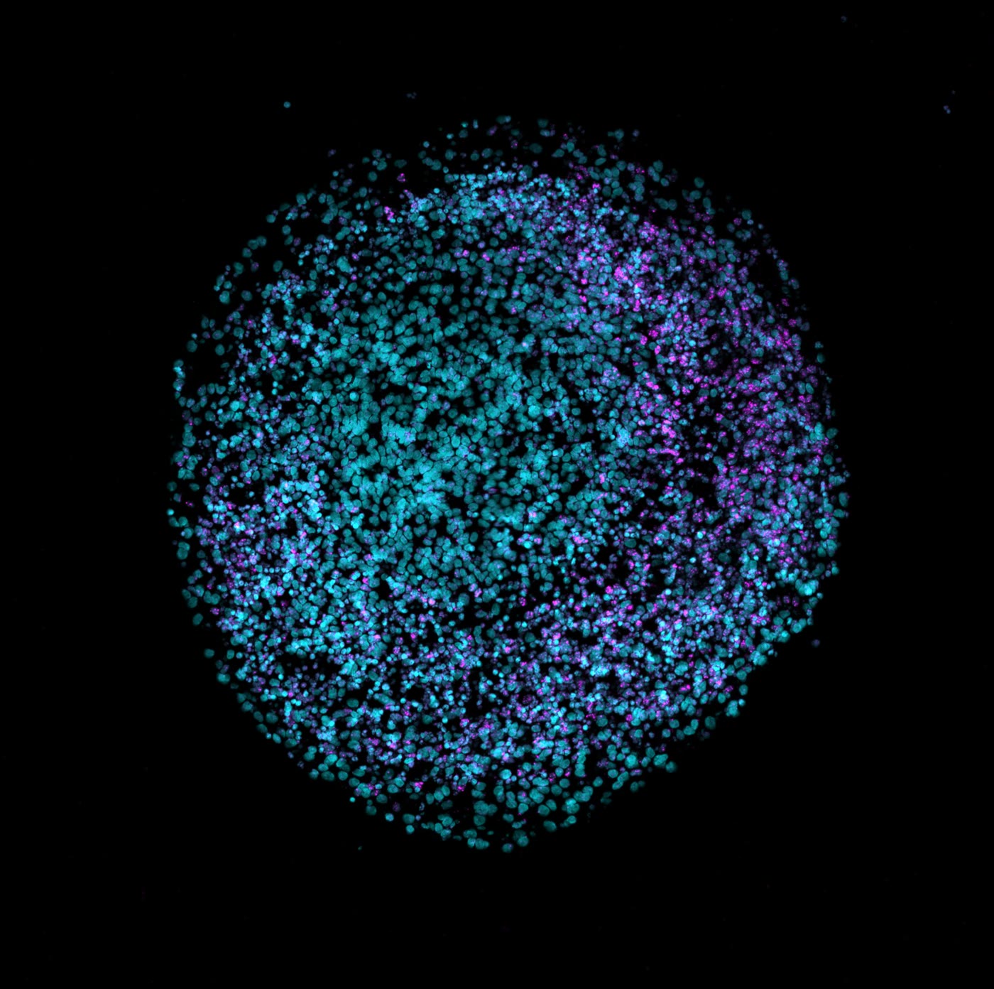 Cross-section of a human brain organoid with cell nuclei stained teal and VIPR2 stained magenta